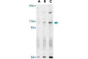 Western blot analysis of ERN1 in A-20 cell lysate with ERN1 polyclonal antibody  at (A) 0. (ERN1 抗体  (N-Term))