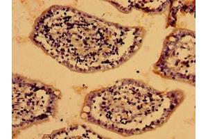 Immunohistochemistry of paraffin-embedded human small intestine tissue using ABIN7158451 at dilution of 1:100 (LIAS 抗体  (AA 28-372))