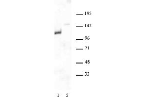 Androgen Receptor antibody (pAb) tested by Western blot. (Androgen Receptor 抗体  (N-Term))