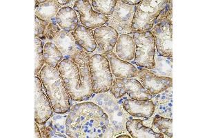 Immunohistochemistry of paraffin-embedded mouse kidney using MMP9 antibody (ABIN7268426) at dilution of 1:100 (40x lens). (MMP 9 抗体  (AA 400-500))