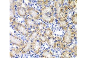 Immunohistochemistry of paraffin-embedded Rat kidney using RARB Polyclonal Antibody at dilution of 1:100 (40x lens). (Retinoic Acid Receptor beta 抗体)
