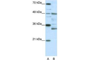 Western Blotting (WB) image for anti-Forkhead Box N2 (FOXN2) antibody (ABIN2461648) (FOXN2 抗体)