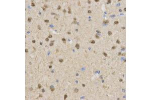 Immunohistochemistry (IHC) image for anti-Transducin-Like Enhancer of Split 1 (E(sp1) Homolog, Drosophila) (TLE1) antibody (ABIN1876687) (TLE1 抗体)
