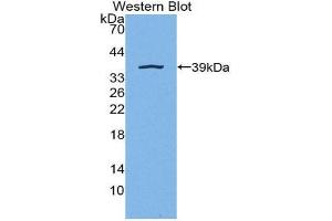 Western Blotting (WB) image for anti-Ligase I, DNA, ATP-Dependent (LIG1) (AA 568-875) antibody (ABIN2119559) (LIG1 抗体  (AA 568-875))