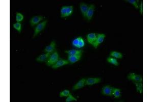 Immunofluorescence staining of HepG2 cells with ABIN7170398 at 1:213, counter-stained with DAPI. (SNX5 抗体  (AA 7-245))