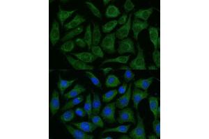 Immunofluorescence analysis of L929 cells using R Polyclonal Antibody (ABIN7269849) at dilution of 1:100 (40x lens). (GRF2 抗体  (AA 844-1095))
