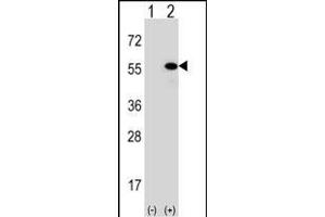 Western blot analysis of DNAJA1 (arrow) using rabbit polyclonal DNAJA1 Antibody (Center) (ABIN652030 and ABIN2840506).