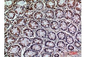 Immunohistochemistry (IHC) analysis of paraffin-embedded Human Colon, antibody was diluted at 1:100.