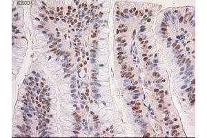 Image no. 3 for anti-Myc Proto-Oncogene protein (MYC) antibody (ABIN1497013) (c-MYC 抗体)