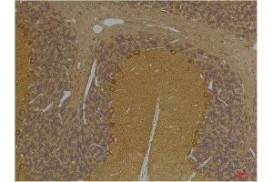 Immunohistochemistry (IHC) analysis of paraffin-embedded Rat Brain Tissue using SLC12A4 Rabbit Polyclonal Antibody diluted at 1:200. (SLC12A4 抗体)