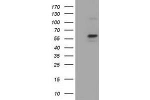 Western Blotting (WB) image for anti-Pyruvate Kinase, Liver and RBC (PKLR) antibody (ABIN1500248) (PKLR 抗体)