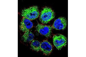 Immunofluorescence (IF) image for anti-General Transcription Factor IIH, Polypeptide 2C (GTF2H2C) (AA 314-343), (C-Term) antibody (ABIN655372)