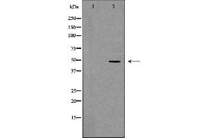Western blot analysis of extracts of HepG2 , using CSF2RA antibody.