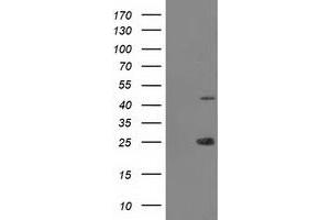 Image no. 1 for anti-Taspase, Threonine Aspartase, 1 (TASP1) antibody (ABIN1501308) (TASP1 抗体)