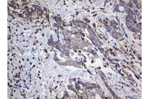 Image no. 7 for anti-NADH Dehydrogenase (Ubiquinone) 1 beta Subcomplex, 10, 22kDa (NDUFB10) antibody (ABIN1499672) (NDUFB10 抗体)