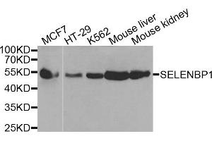 Western blot analysis of extracts of various cells, using SELENBP1 antibody. (SELENBP1 抗体)
