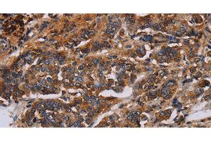 Immunohistochemistry (Paraffin-embedded Sections) (IHC (p)) image for anti-Potassium Voltage-Gated Channel, KQT-Like Subfamily, Member 1 (KCNQ1) antibody (ABIN7241600)