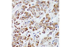 Immunohistochemistry (IHC) image for anti-Deoxyuridine Triphosphatase (DUT) (AA 89-252) antibody (ABIN7266736)