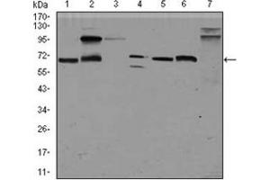 Western Blotting (WB) image for anti-Glypican 3 (GPC3) antibody (ABIN1107403)