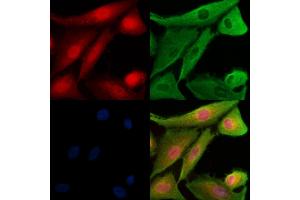 Phospho-TAO2 (Ser181) Antibody staining A549 cells(H2O2 treatment) by IF/ICC. (TAO Kinase 2 抗体  (pSer181))