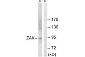 Western blot analysis of extracts from Jurkat cells, using ZAK (Ab-165) Antibody. (ZAK 抗体  (AA 131-180))