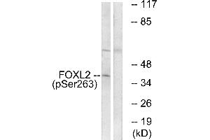 Western blot analysis of extracts from K562 cells, treated with Na3VO4 (0. (FOXL2 抗体  (pSer263))