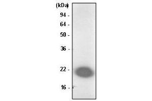 Jurkat cell lysate was resolved by SDS-PAGE, transferred to PVDF membrane and probed with anti-human Park7/DJ-1 antibody (1:1000). (PARK7/DJ1 抗体  (AA 1-189))