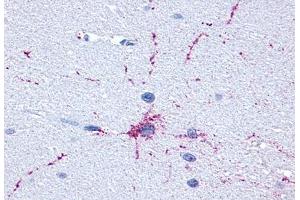 Anti-GRM8 / MGLUR8 antibody  ABIN1048946 IHC staining of human brain, neurons and glia. (GRM8 抗体  (C-Term))