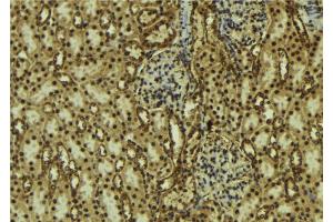ABIN6273754 at 1/100 staining Mouse kidney tissue by IHC-P. (PIK3C2B 抗体  (Internal Region))