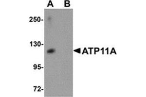 Western blot analysis of ATP11A in K562 cell tissue lysate with ATP11A antibody at 1 μg/ml in (A) the absence and (B) the presence of blocking peptide. (ATP11A 抗体  (N-Term))