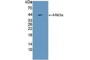 Detection of Recombinant GHR, Human using Polyclonal Antibody to Growth Hormone Receptor (GHR) (Growth Hormone Receptor 抗体  (AA 315-574))