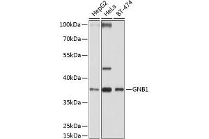 GNB1 抗体  (AA 1-340)