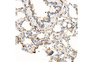Immunohistochemistry of paraffin-embedded rat lung using [KO Validated] MyD88 Rabbit mAb (ABIN7268723) at dilution of 1:1000 (40x lens). (MYD88 抗体)