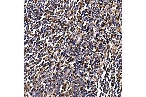 Immunohistochemistry of paraffin-embedded human tonsil using C Rabbit pAb (ABIN6130035, ABIN6137891, ABIN6137892 and ABIN6220925) at dilution of 1:100 (40x lens). (CAMK4 抗体  (AA 304-473))