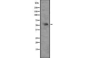 Western blot analysis of CXCR7 expression in HEK293 cells ,The lane on the left is treated with the antigen-specific peptide.