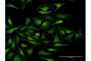 Immunofluorescence of purified MaxPab antibody to KIAA0101 on HeLa cell. (KIAA0101 抗体  (AA 1-111))