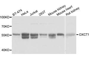Western blot analysis of extracts of various cell lines, using OXCT1 antibody. (OXCT1 抗体)