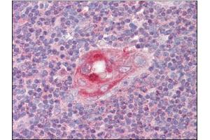 Human Thymus (formalin-fixed, paraffin-embedded) stained with RGS1followed by biotinylated anti-goat IgG secondary antibody, alkaline phosphatase-streptavidin and chromogen. (RGS1 抗体  (C-Term))
