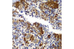 Immunohistochemistry of paraffin-embedded rat spleen using PRKAB1 antibody (ABIN5995401) at dilution of 1/100 (40x lens). (PRKAB1 抗体)