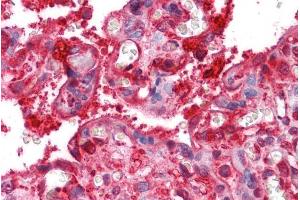 ABIN185665 (2. (Radixin 抗体  (Internal Region))