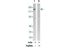 Western blot analysis of extracts from LoVo cells, treated with H 2 O 2  (100 uM, 30 mins), using PDGFRB polyclonal antibody .