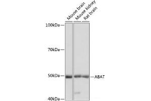Western blot analysis of extracts of various cell lines using ABAT Polyclonal Antibody at dilution of 1:1000. (ABAT 抗体)