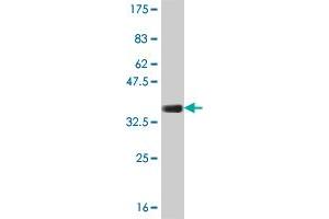 Western Blotting (WB) image for anti-Collagen, Type XXIII, alpha 1 (COL23A1) (AA 338-410) antibody (ABIN530057)