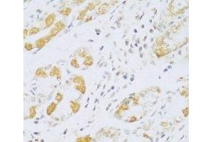 Immunohistochemistry of paraffin-embedded Human stomach using FDXR Polyclonal Antibody at dilution of 1:100 (40x lens). (Ferredoxin Reductase 抗体)