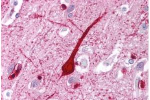 Human Brain, Cortex (formalin-fixed, paraffin-embedded) stained with E2F4 antibody ABIN214109 at 5 ug/ml followed by biotinylated goat anti-rabbit IgG secondary antibody ABIN481713, alkaline phosphatase-streptavidin and chromogen. (E2F4 抗体  (C-Term))