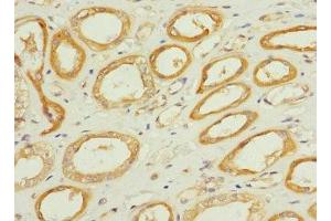 Immunohistochemistry of paraffin-embedded human kidney tissue using ABIN7171975 at dilution of 1:100 (TPK1 抗体  (AA 1-243))