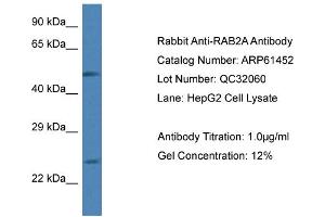 Western Blotting (WB) image for anti-RAB2A, Member RAS Oncogene Family (RAB2A) (C-Term) antibody (ABIN2788809) (RAB2A 抗体  (C-Term))