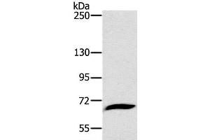 Western Blot analysis of Mouse liver tissue using CD42b Polyclonal Antibody at dilution of 1:800 (CD42b 抗体)