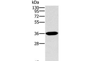 Western Blot analysis of Human fetal intestine tissue using ITLN1 Polyclonal Antibody at dilution of 1:400 (ITLN1/Omentin 抗体)