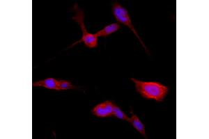 Confocal immunofluorescence - anti-Catenin beta1 Ab in BEAS-2B cells at 1/250 dilution, cells were fixed with 4% of PFA, (beta Catenin 抗体  (C-Term))